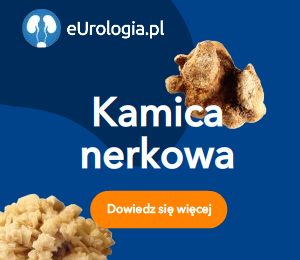 eUrologia.pl - Urologia - poradnik dla pacjentów. Choroby układu moczowego - diagnostyka ileczenie.